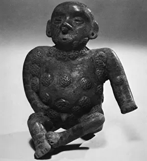 Carvings Prints: Figure Showing Syphilis Symptoms