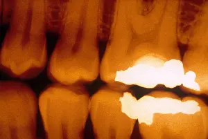 Test Prints: Fillings, X-ray
