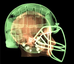 Mixed Science Images Prints: Football Helmet, X-Ray