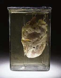 Shot Prints: Forensic Evidence, Heart Perforated by Bullet, 1937