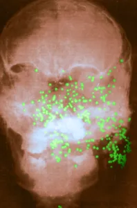Technique Prints: Forensic X-Ray of Murder Victim