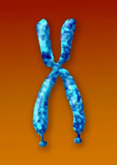 Mental Prints: Fragile X Syndrome (FXS) is a genetic condition often associated with autism spectrum disorder (ASD)