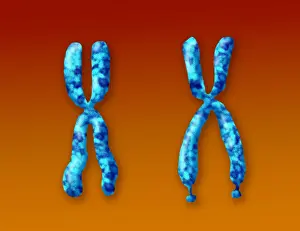 Mental Prints: Fragile X Syndrome (FXS) is a genetic condition often associated with autism spectrum disorder (ASD)