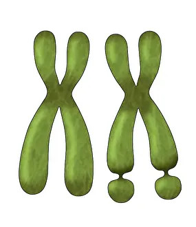 Disability Prints: Fragile X Syndrome (FXS) is a genetic condition often associated with autism spectrum disorder (ASD)