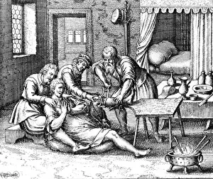 Amputation Prints: Gangrene Amputation of Leg, 17th Century