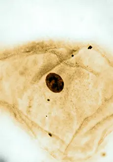 Inactive Prints: Genetics, Barr Body, light micrograph