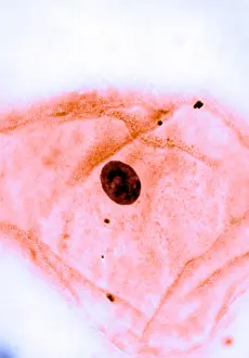 Non Pathological Prints: Genetics, Barr Body, light micrograph