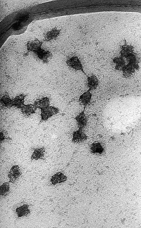 Macromolecule Prints: Genetics, Messenger RNA (mRNA), TEM