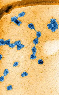 Macromolecule Prints: Genetics, Messenger RNA (mRNA), TEM