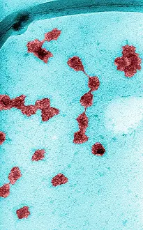 Non Pathological Prints: Genetics, Messenger RNA (mRNA), TEM