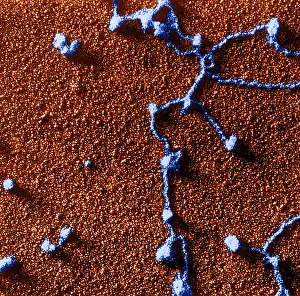Freeze Prints: Genetics, RNA Attached to DNA, TEM