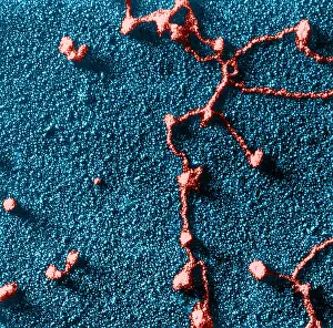 Freeze Prints: Genetics, RNA Attached to DNA, TEM