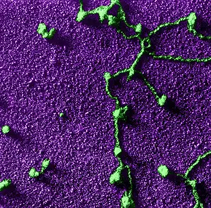 Freeze Prints: Genetics, RNA Attached to DNA, TEM