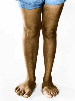 Physical Prints: Gigantism