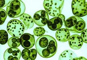 Medical Prints: Green algae, Volvox sp. light micrograph