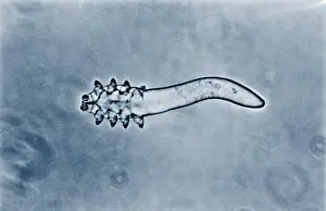 Mite Prints: Hair follicle mite