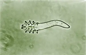 Mite Prints: Hair follicle mite