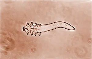 Mite Prints: Hair follicle mite