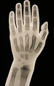 Research Prints: Hand x-ray of a 2 year old child