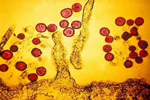 Virus Prints: Hanta Virus (TEM)