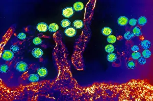 Virus Prints: Hanta Virus (TEM)
