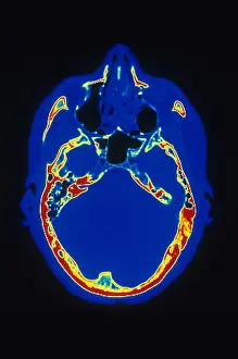 Project Prints: Head, CT Scan