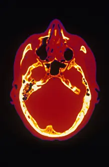 Project Prints: Head, CT Scan