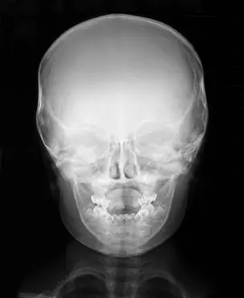 Diagnosis Prints: Head Healthy 3 Year Old Boy