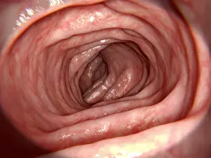 Intestines Prints: Healthy intestine