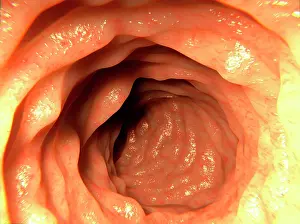 Normal Prints: Healthy intestine, artwork