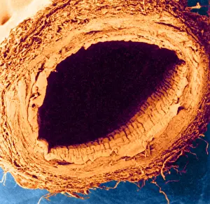 Vein Prints: Healthy Vein, under a microscope (SEM)