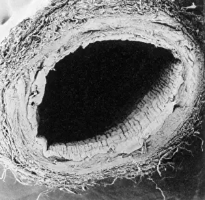 2010 Prints: Healthy Vein, under a microscope (SEM)