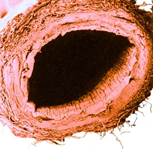 Vein Prints: Healthy Vein, under a microscope (SEM)