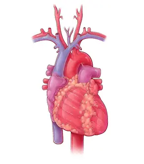 Trunk Prints: Heart, Illustration