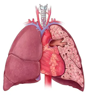 Trending: Heart and Lung Anatomy, Illustration