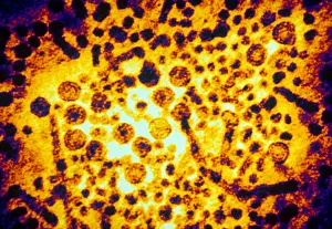 Histology Prints: Hepatitis B Virus (TEM)