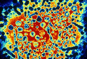 Tems Prints: Hepatitis B Virus (TEM)