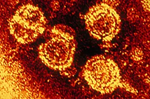 Virus Prints: Hepatitis B Virus (TEM)