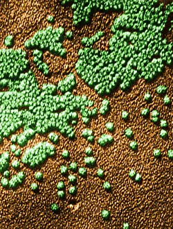 Histopathic Prints: Hepatitis Virus