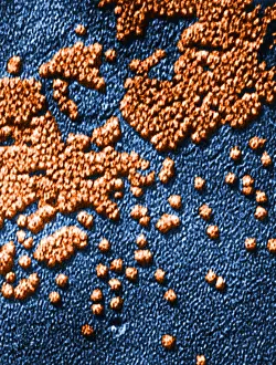 Histopathic Prints: Hepatitis Virus