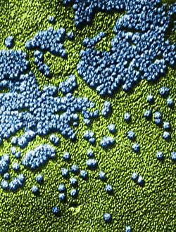 Histopathic Prints: Hepatitis Virus