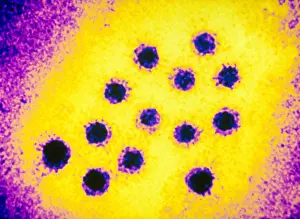 Virus Prints: Hepatitis A Virus (TEM)