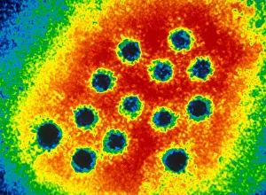 Virus Prints: Hepatitis A Virus (TEM)