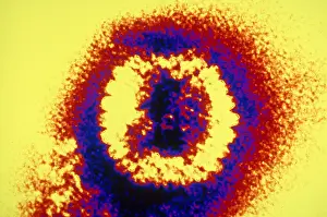 Histology Prints: Herpes Simplex Virus (TEM)