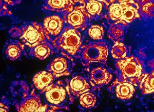 Histology Prints: Herpes Simplex Virus (TEM)