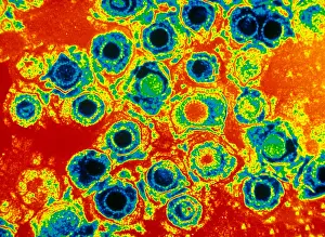 Tems Prints: Herpes Simplex Virus (TEM)