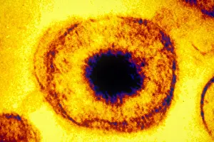 Tems Prints: Herpes Simplex Virus (TEM)