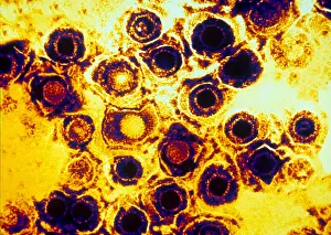 Virus Prints: Herpes Simplex Virus (TEM)