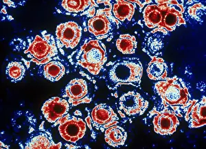 Virus Prints: Herpes Simplex Virus (TEM)
