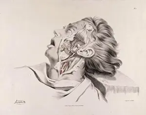 Neck Prints: Historical Anatomical Illustration